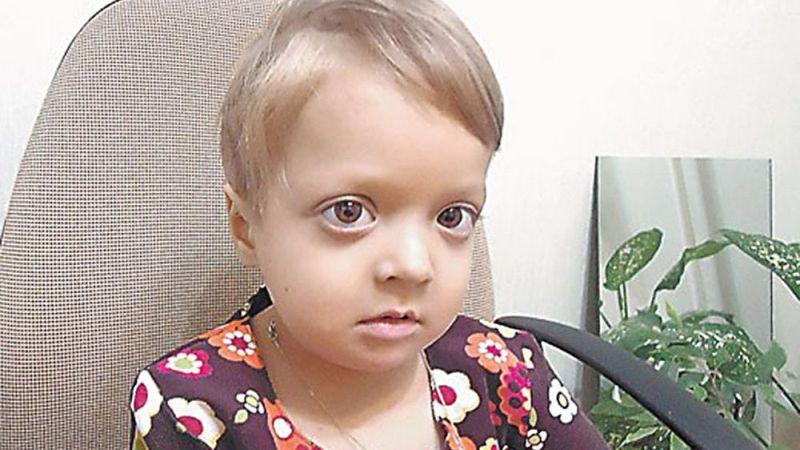 Что такое остеопетроз