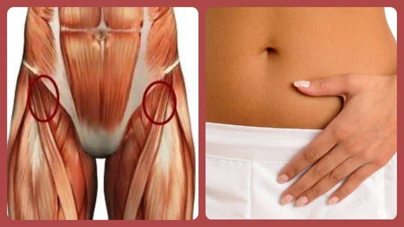 Растяжение паховой связки