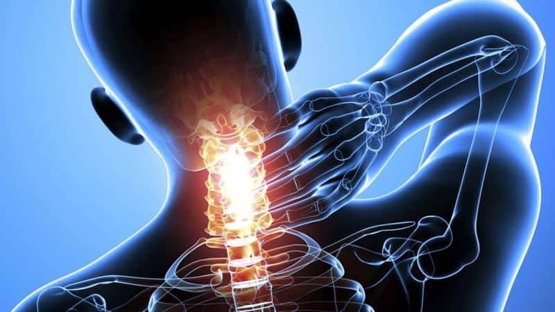 Как лечить перелом шейного позвонка
