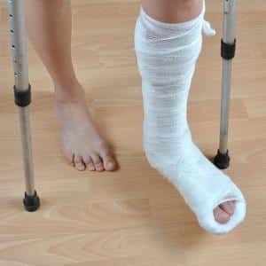 Как лечить перелом пяточной кости