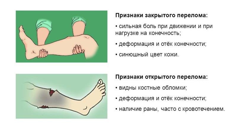 Признаки
