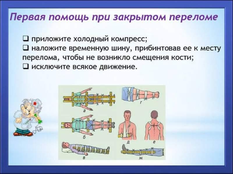 Помощь при закрытом переломе