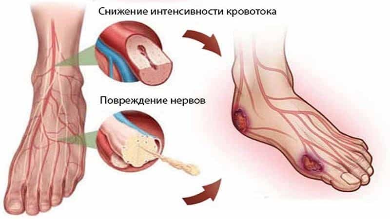 Почему у детей болят ноги