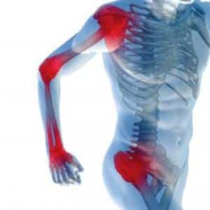 Как применять мазь Суставной доктор