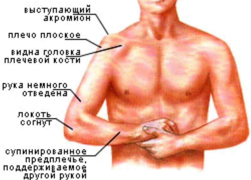 Симптоматика