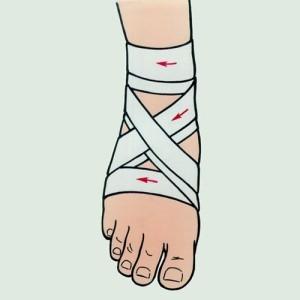 Как наложить повязку на голеностопный сустав