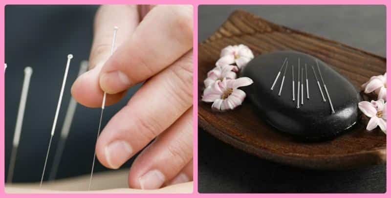 Проведение процедуры