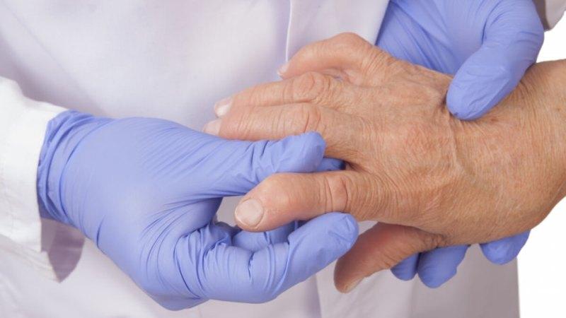 Как лечить ревматоидный артроз