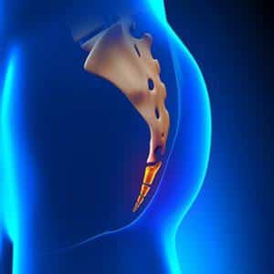 Как лечить смещение копчика