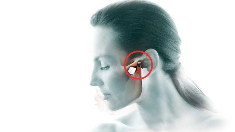 Как лечить дисфункцию височно-нижнечелюстного сустава