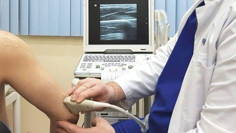 Как лечить синовит локтевого сустава