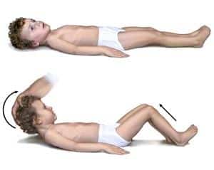 Что такое симптомы Кернига и Брудзинского