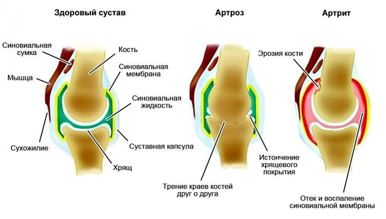 Что такое синовиальная жидкость