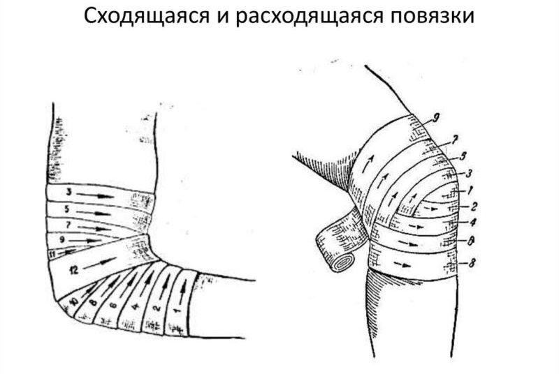Как правильно сделать повязку на колено