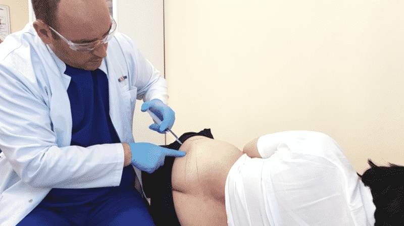 Проведение процедуры